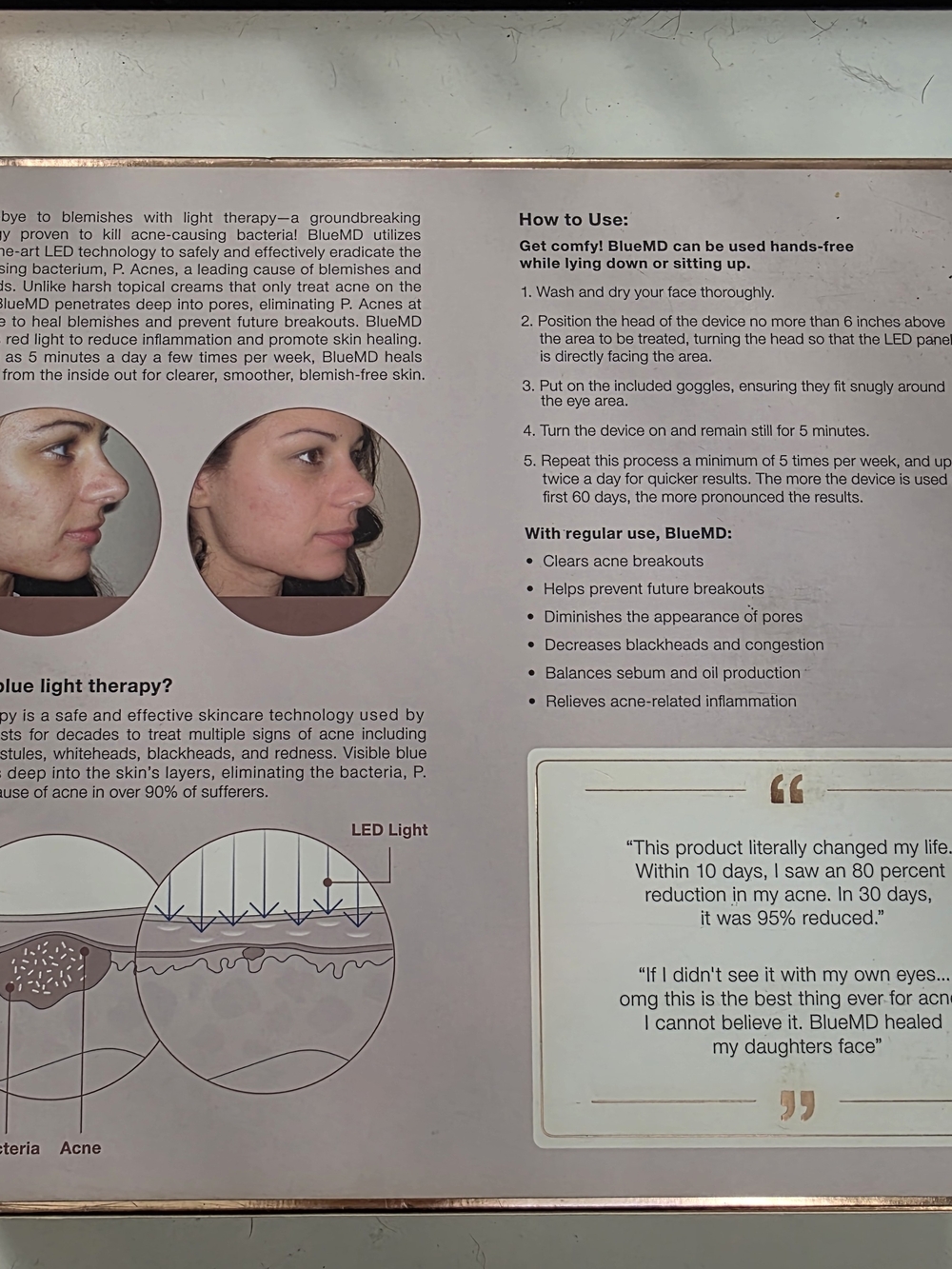 BlueMD Blue LED Light Therapy System - Picture 2 of 3